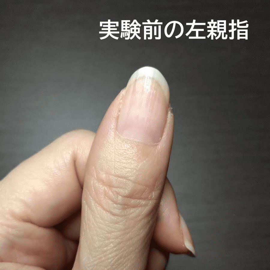 実験前の左親指